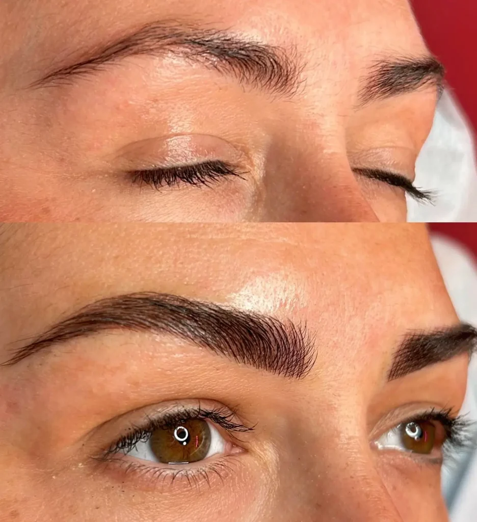 Trends from the Treatment Room