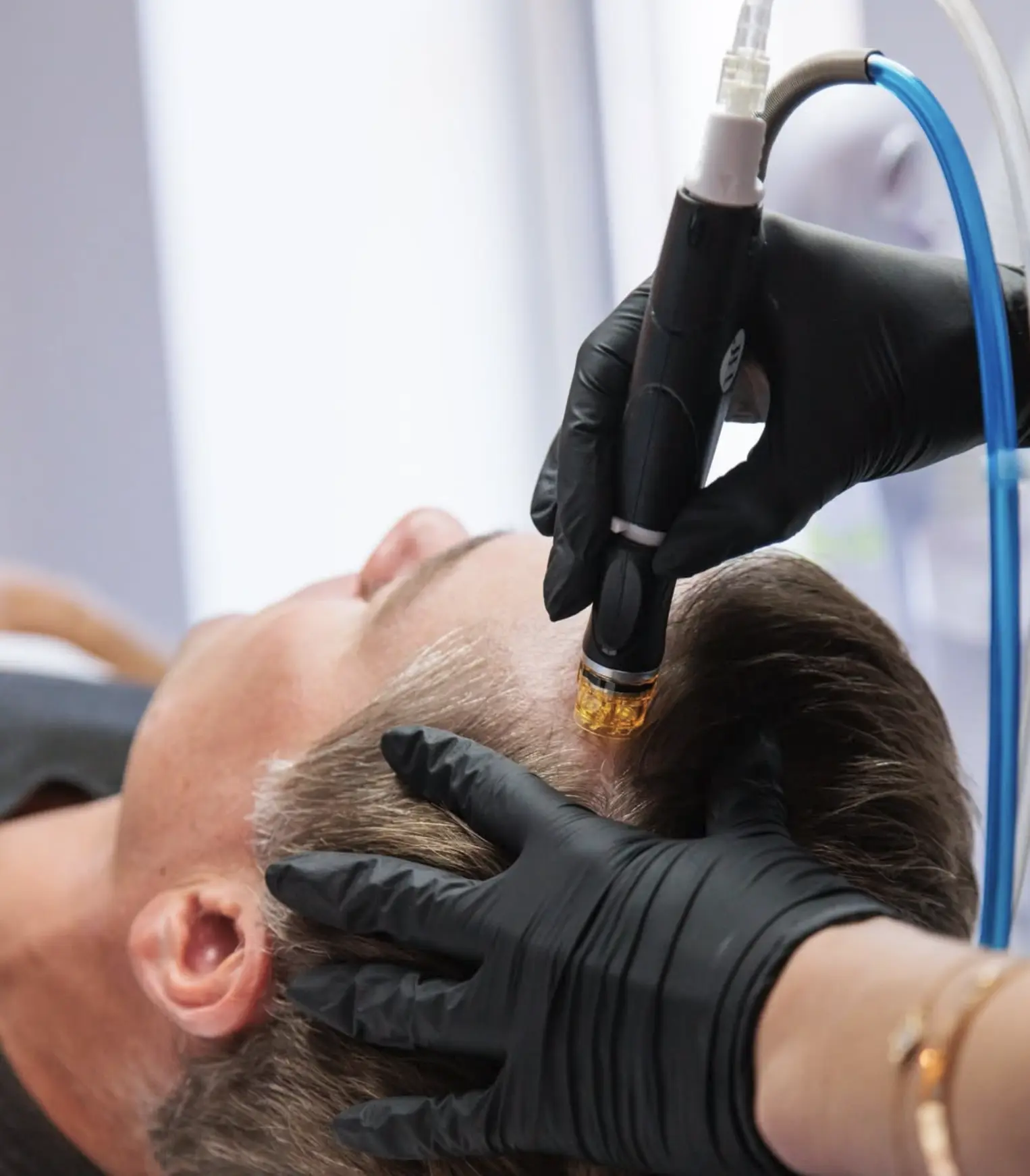 hydrafacial before and after