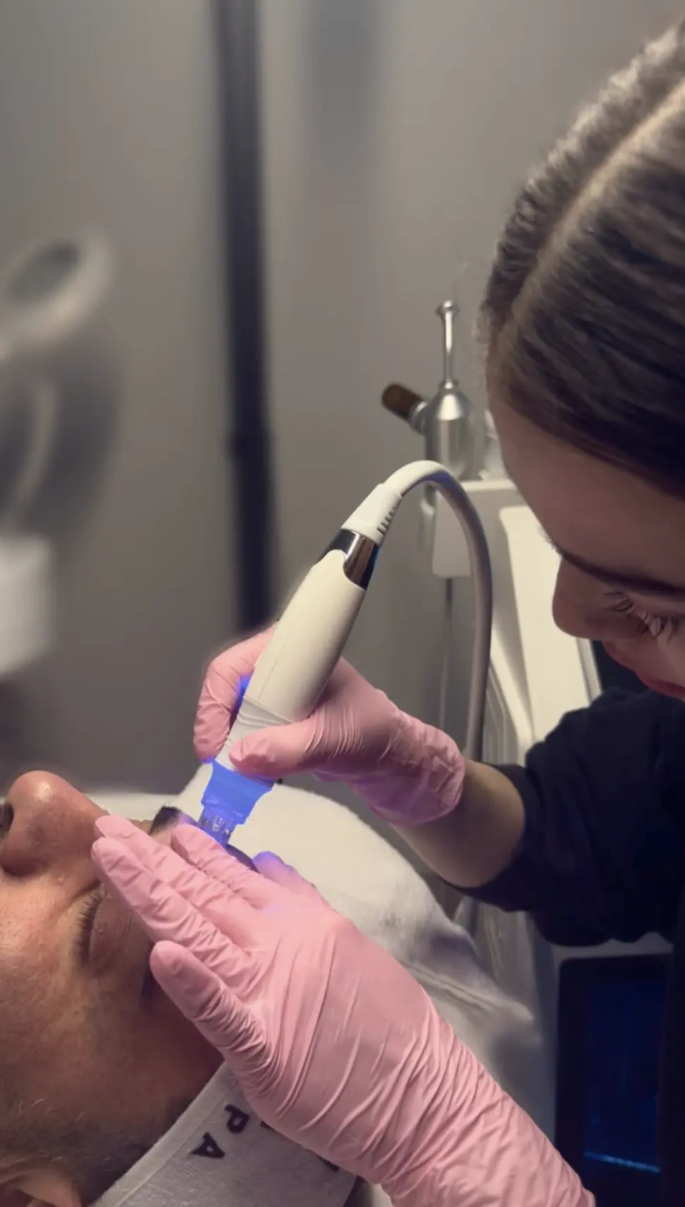 Will Hydrafacial Trigger Your Perioral Dermatitis?