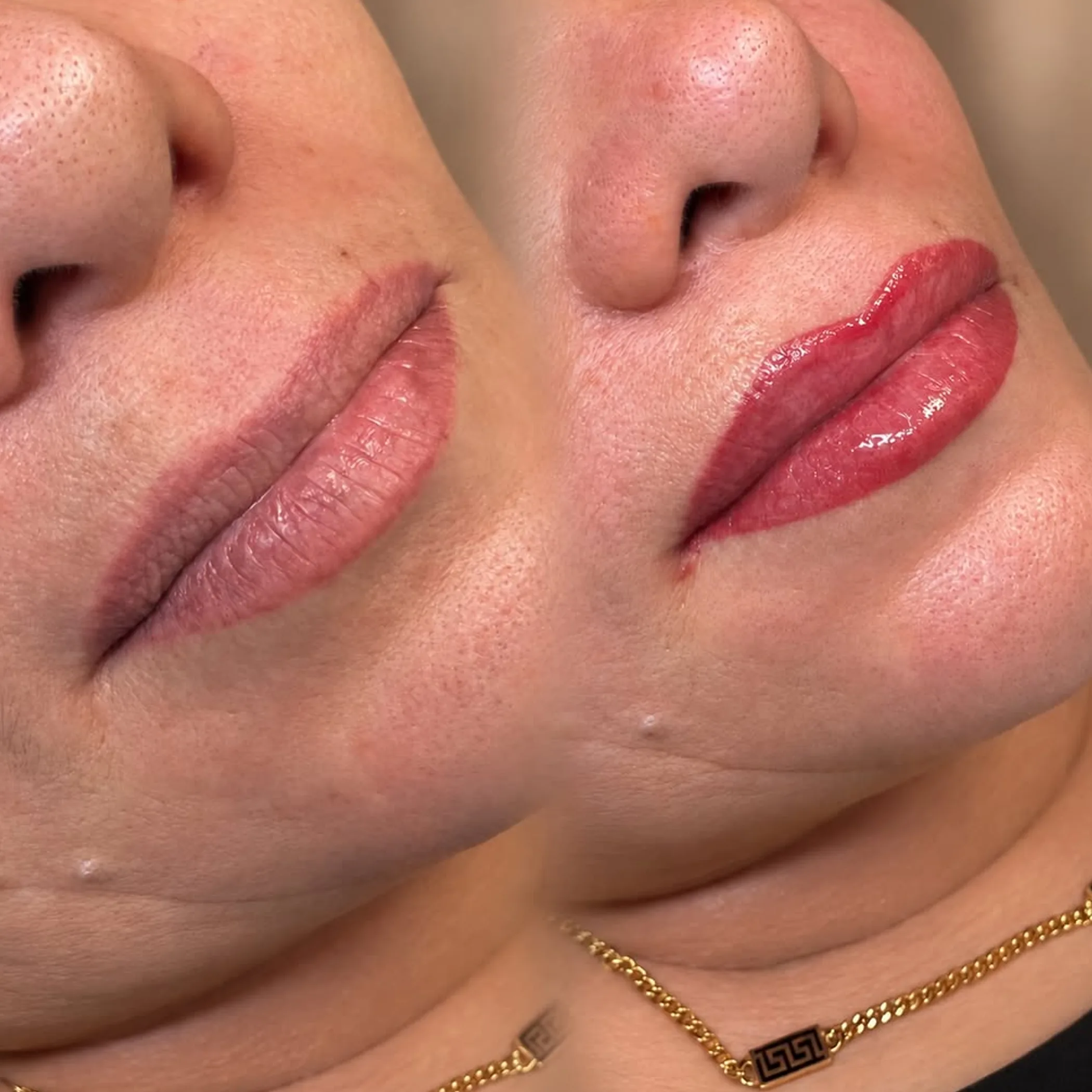 lip pigmentation and customized symmetry